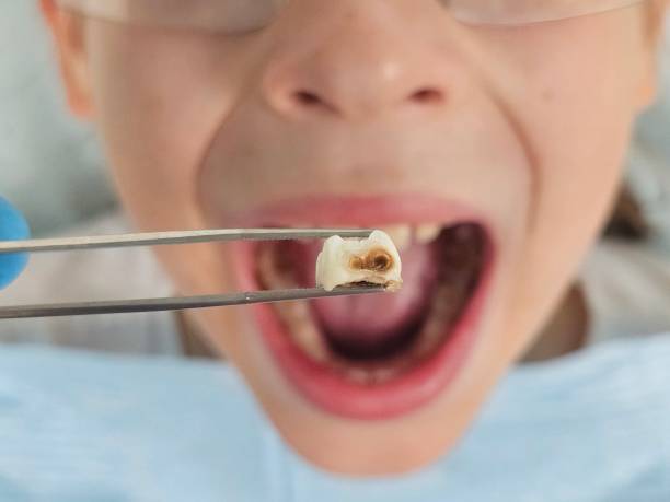 Best Urgent Care for Lost Fillings or Crowns in Mapleton, ND